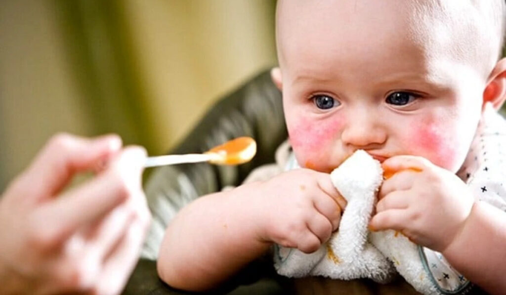 Alergia alimentar em bebês e crianças: por que é muito comum? | Dra. Juliana Guirado